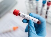 Tes HIV: Kapan Waktu yang Tepat dan Apa yang Harus Disiapkan?